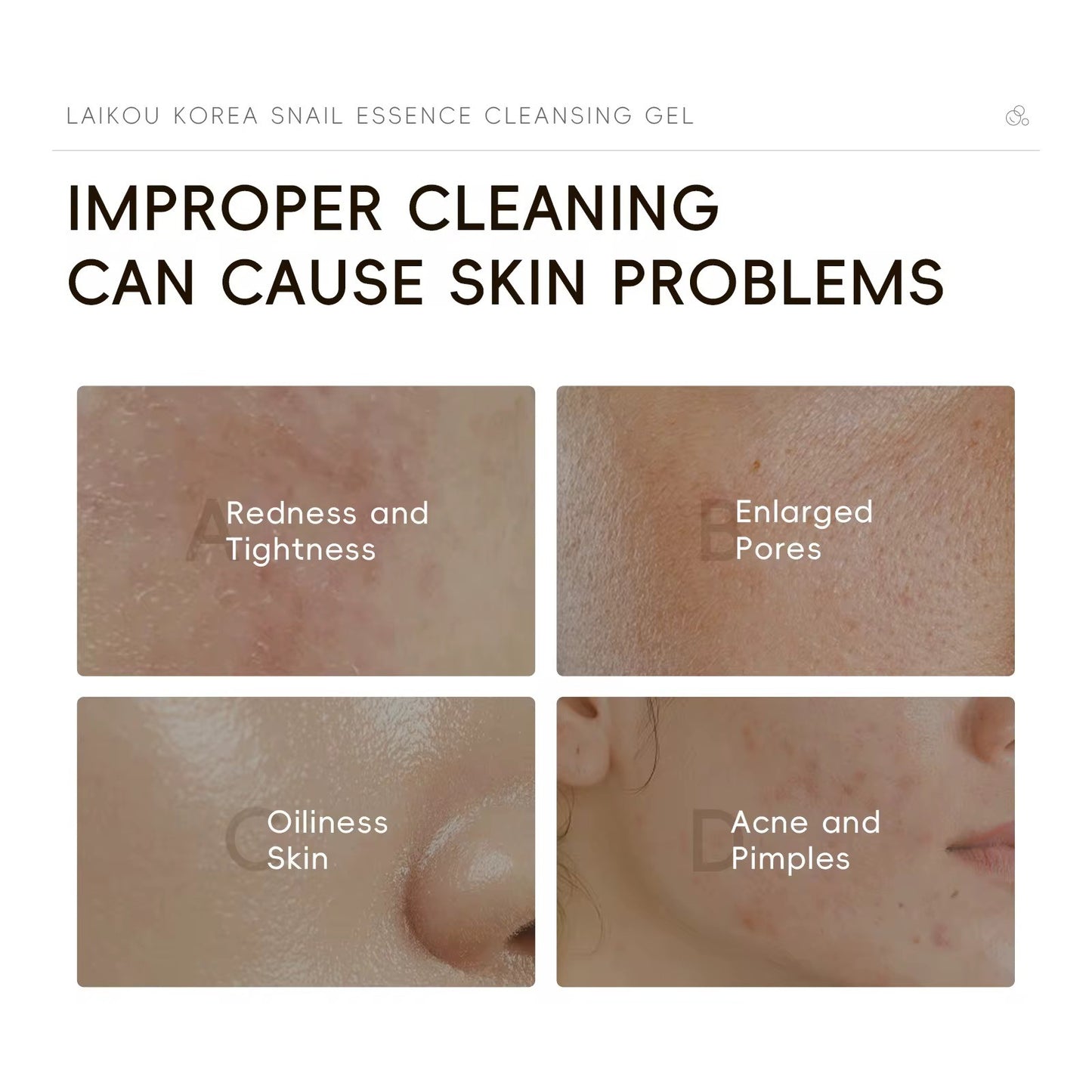 Snail Essence Cleansing Gel, The face wash for all queens